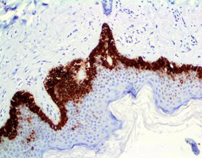 Cytokeratin15 CK15