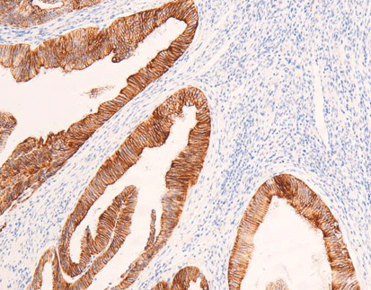 Cytokeratin18 CK18