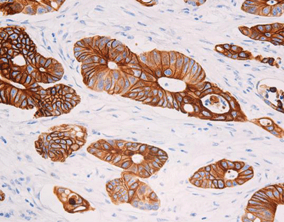 Cytokeratin 20 CK20, anti-mouse,monoclonal, Ks20.8