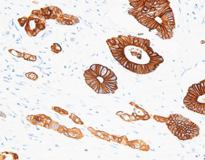 Cytokeratin 20 CK20, anti-mouse,monoclonal,Ks20.8