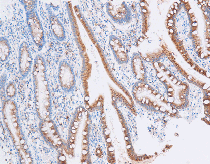 Epithelial Membrane Antigen (EMA),anti-mouse, E29