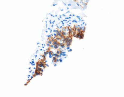 Epithelial Specific Antigen/Ep-CAM