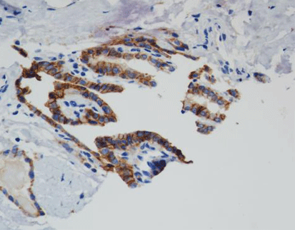 Epithelial Specific Antigen/Ep-CAM