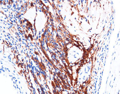 Glial Fibrillary Acidic Protein (GFAP)