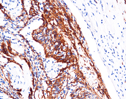 Glial Fibrillary Acidic Protein (GFAP)