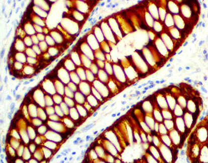 CytokeratinPan