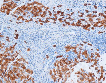 Cytokeratin8 CK8