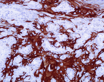 Cytokeratin10 CK10