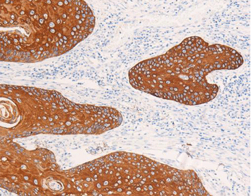 Cytokeratin14 CK14