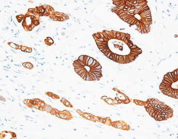 Cytokeratin 20 CK20, anti-mouse,monoclonal,Ks20.8