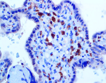 Factor VIII-Ralated Antigen (Human von Willebrand Factor )