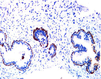 Cytokeratin Multi(HMW)