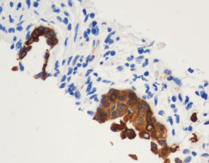 Cytokeratin Multi(HMW)