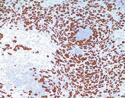 Cytokeratin (LMW)