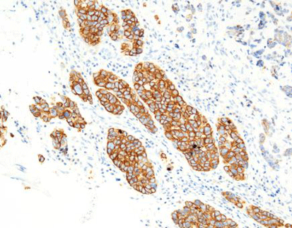 Cytokeratin (LMW)