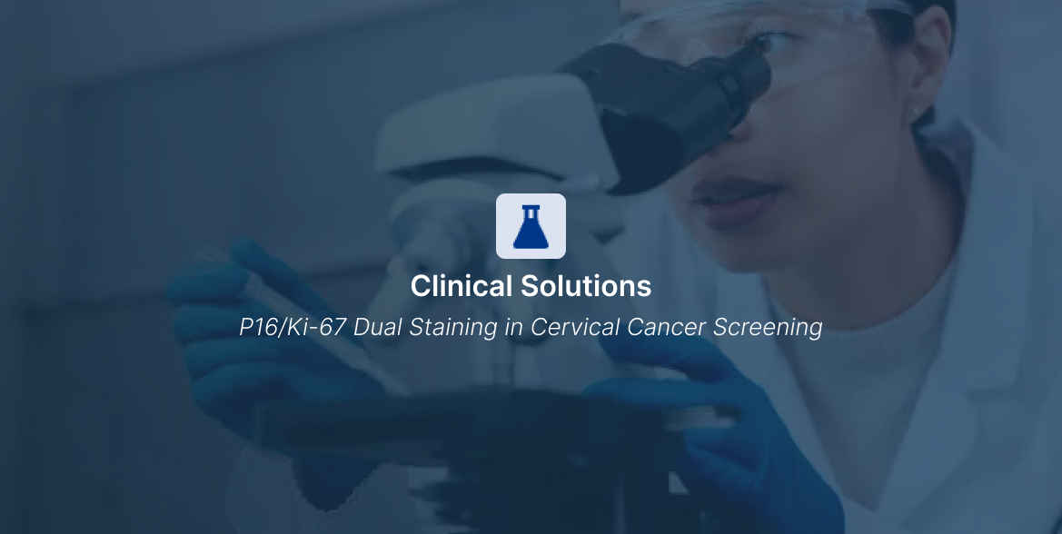 P16/Ki-67 Dual Staining in Cervical Cancer Screening