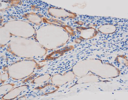 Thyroid Peroxidase(TPO)