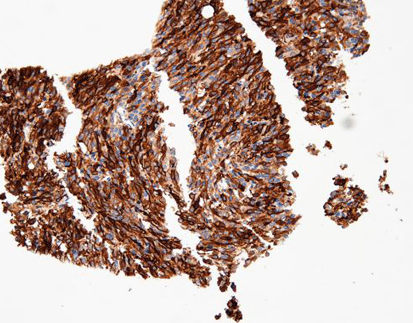 Thyroid Stimulating Hormone(TSH)