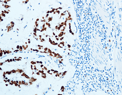 Topoisomerase TOPIIα