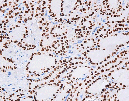 Thyroid Transcription Factor-1 (TTF-1), anti-mouse, SPT24