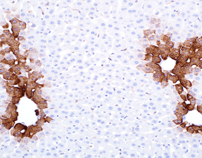 Glutamine Synthetase