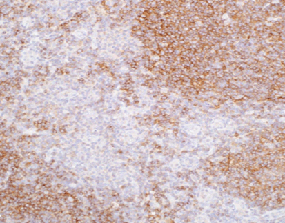 Human germinal center-associated lymphoma(HGAL)