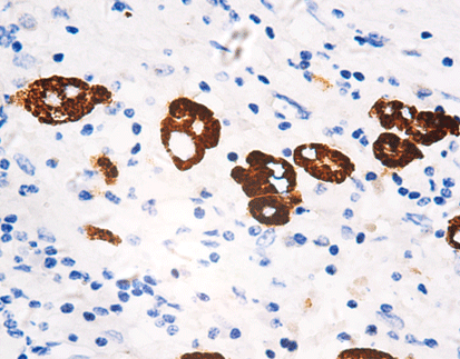 Hepatocyte Specific Antigen (HSA)