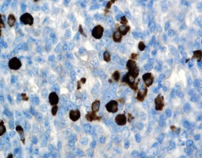 Immunoglobulin G