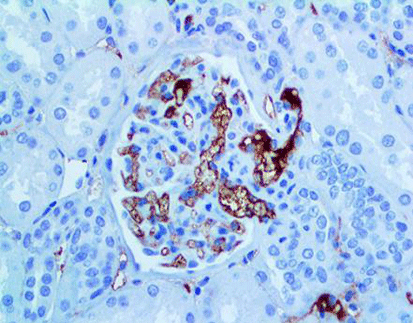 Immunoglobulin M