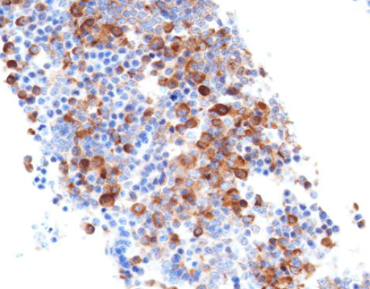 Luteinizing Hormone(LH)