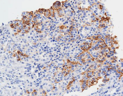 Mesothelial cell (HBME-1)