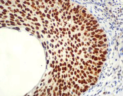 MCM5 Protein