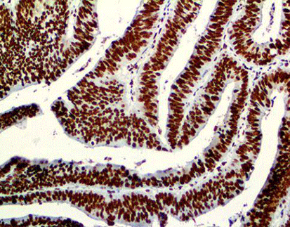 Mismatch Repair Protein(MSH2),anti-mosue, G219-1129