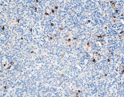 Myeloperoxidase (MPO)