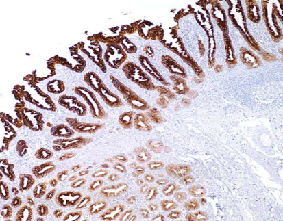 Mucin-2 Glycoprotein