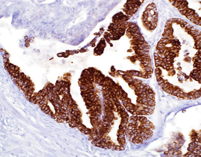 Mucin-5AC Glycoprotein