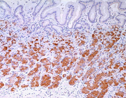 Mucin-6 Glycoprotein