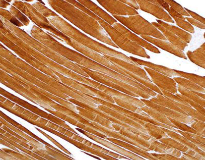 Muscle Specific Actin (MSA)