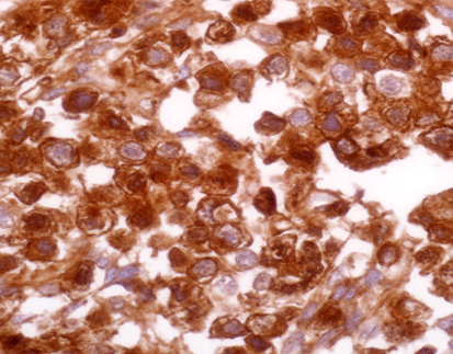 Human Chorionic Gonadotrophin(HCG)