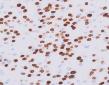 Olig-2