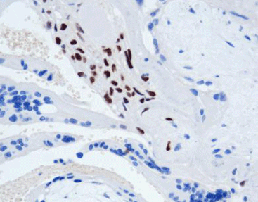 P57 Protein (Kip2)