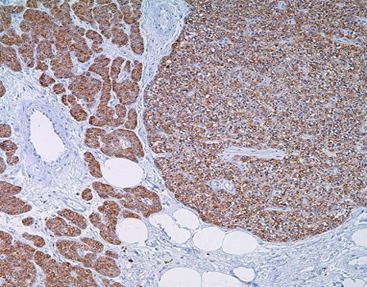 Parathyroid Hormone (PTH)