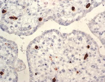 Parvovirus B19