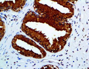 Prostate Specific Acid Phosphatase (PSAP)