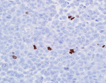 PHH3