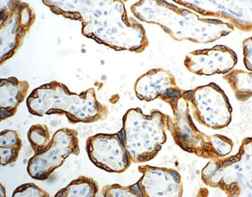 Placental Alkaline Phosphatase (PLAP)