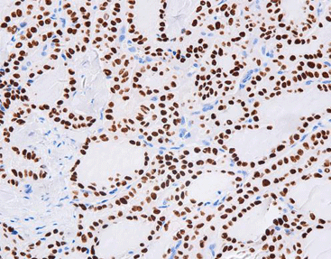 Thyroid Transcription Factor-1 (TTF-1), anti-mouse, SPT24