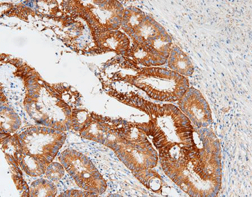 Lung- resistance related protein