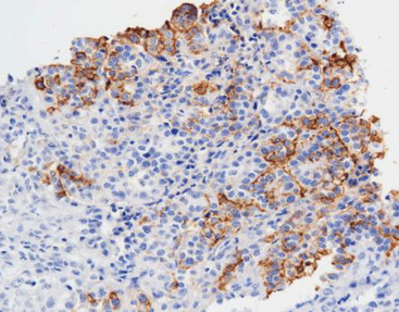 Mesothelial cell (HBME-1)