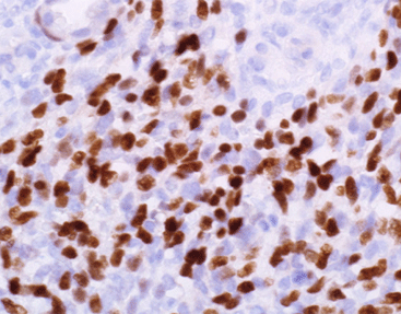 Myogenin